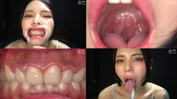 &quot;【Teeth/Oral Mouth】Extremely cute former queen&#39;s very precious teeth, mouth, and uvula observation play&quot; Haruki Kanae